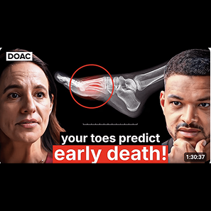 The Foot Specialist: Your Toes Can Predict If You’ll Die Early! This Will Fix Plantar Fasciitis!